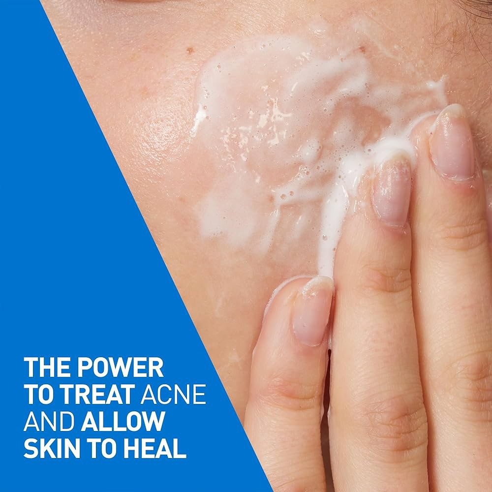 CeraVe Acne Foaming Cleanser 150 mL 2 pack - Lumi and Leo